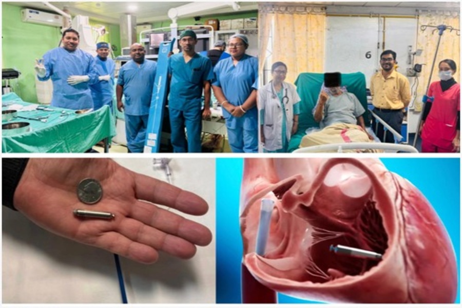 Coin-Sized but Life-Saving: GBP Hospital Achieves Landmark Success with First Leadless Pacemaker Implantation