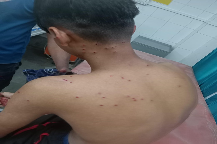 Two Youths Injured by BSF Gunfire During Alleged Smuggling Attempt